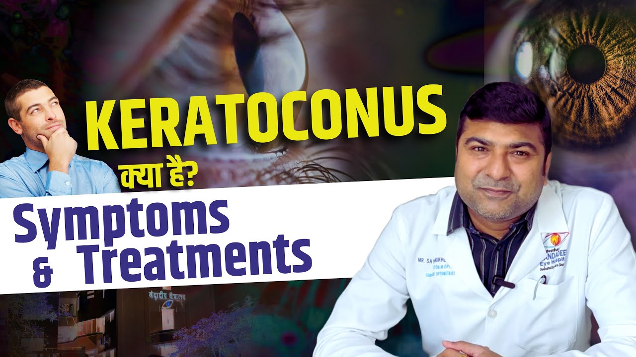 Keratoconus Symptoms & Treatment – आपकी आँखों की सेहत के लिए ज़रूरी जानकारी!