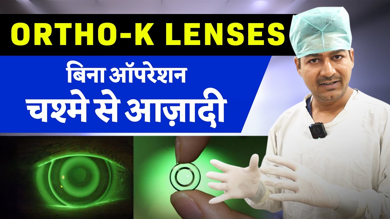 Ortho-K Lenses बिना ऑपरेशन चश्मे से आज़ादी
