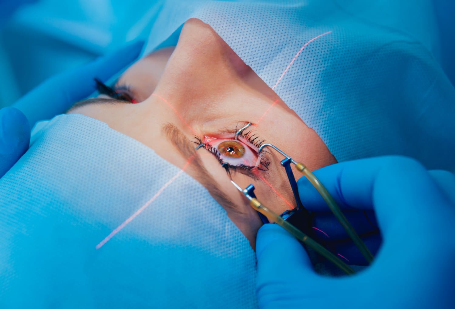 Vitreo retinal surgical service