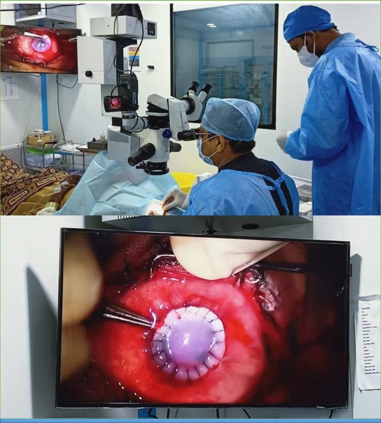 1st Eye implant surgery-Nandadeep