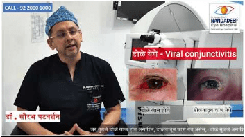 डोळे येणे / Viral Conjunctivitis / ...