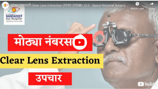 CLE space removal surgery YouTube thumbnail image in nandadeep