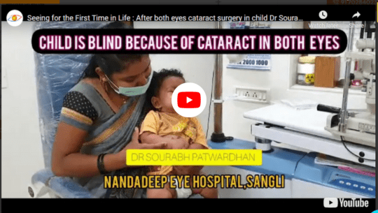 baby see first time catract surgery vedio thumbnail