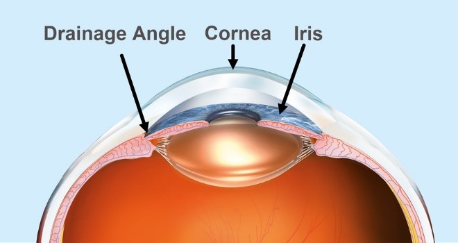 Diagnose and Treat Glaucoma