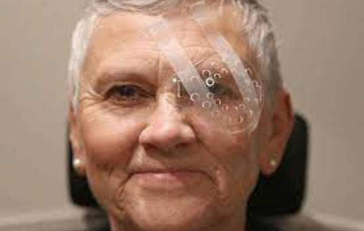 Recovery cataract surgery