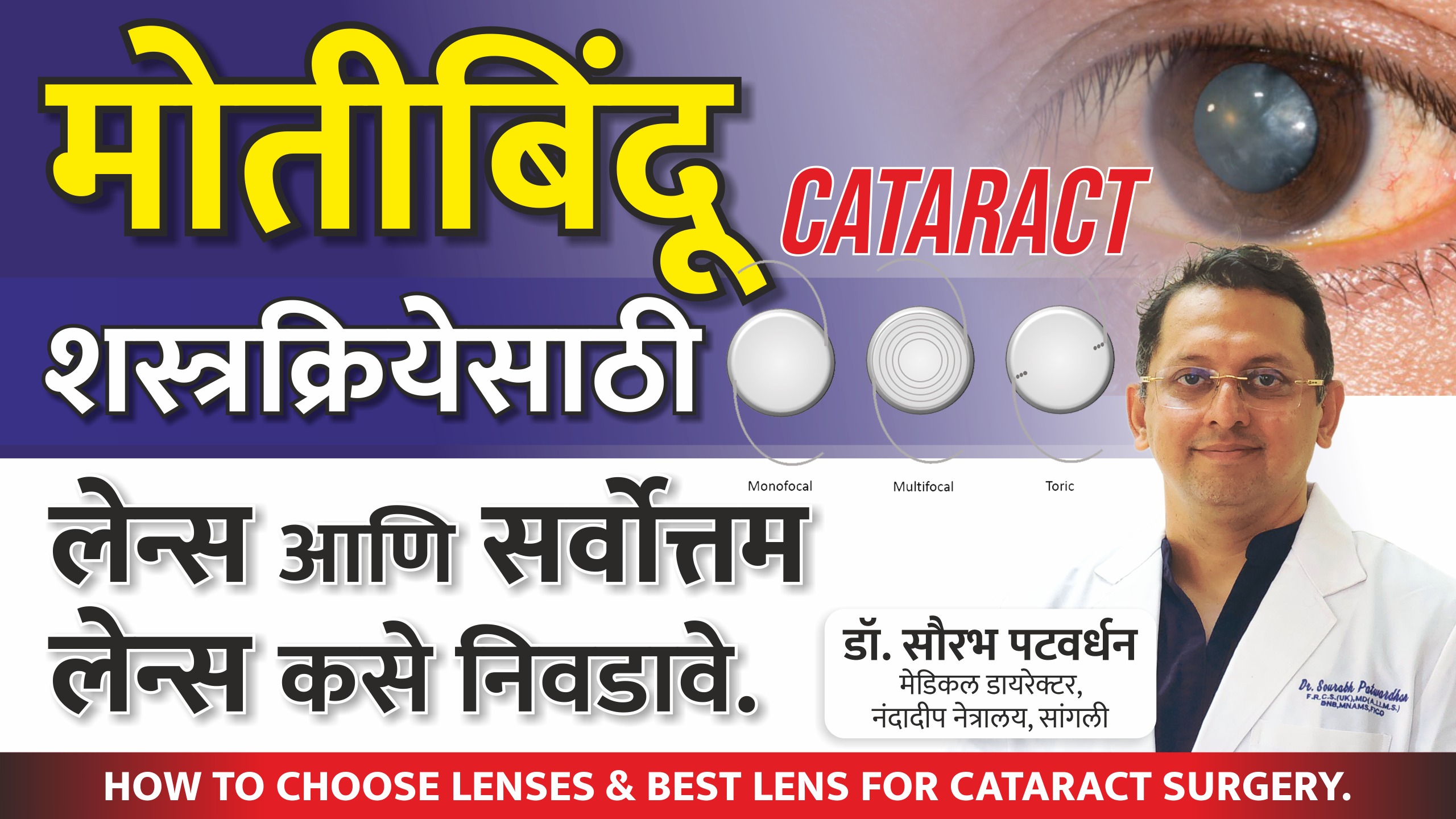 How to choose lenses & best lens for cataract surgery| मोतीबिंदू शस्त्रक्रियेसाठी लेन्स कसे निवडावे.