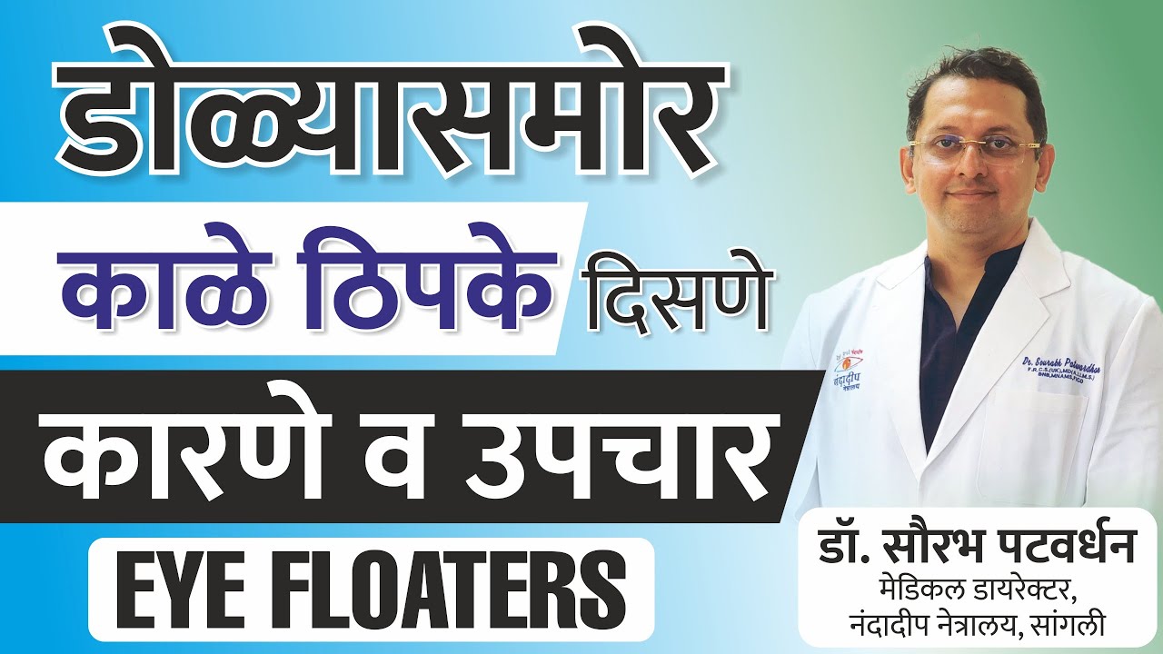 डोळ्यासमोर काळे ठिपके दिसणे कारणे व उपचार Marathi | Eye Floaters Risks & Treatments