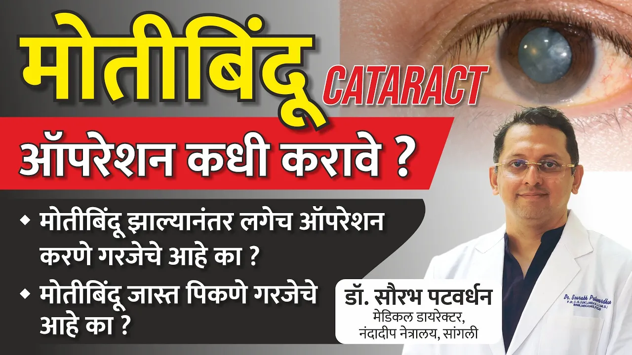 मोतीबिंदू ऑपरेशन कधी करावे |मोतीबिंदू जास्त पिकणे गरजेचे आहे का | When is Cataract Surgery Necessary