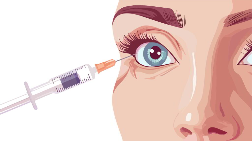 Eye Injections Explanation