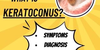 Blog Feature Image Keratoconus