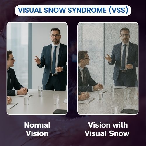 Visual Snow Syndrome