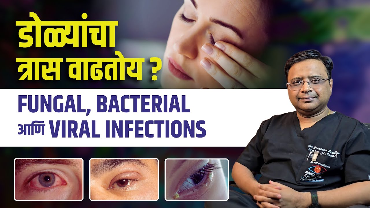 डोळ्यांमध्ये चिकट पाणी लालसरपणा आणि ठणक? Bacterial Infection | Viral Infection | Corneal Infection