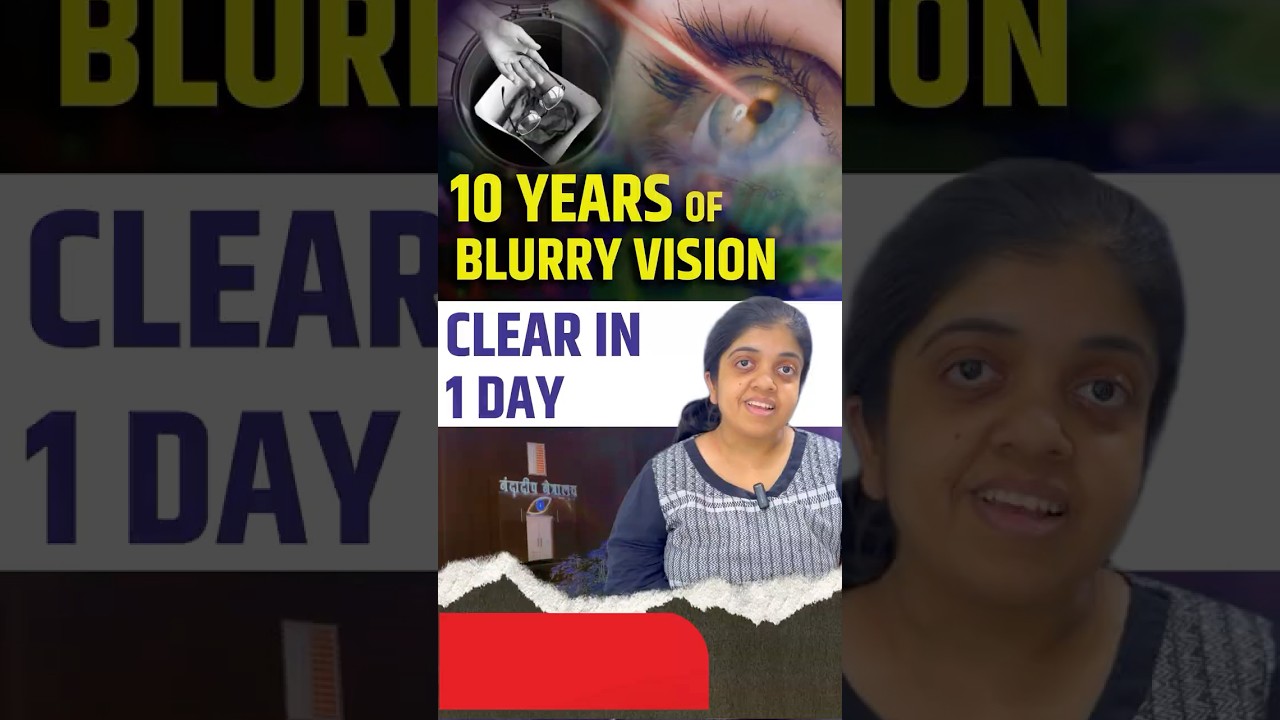 10 Year Eye Problem Finally Solved at Nandadeep Eye Hospital | SMILE (Klex) Treatment