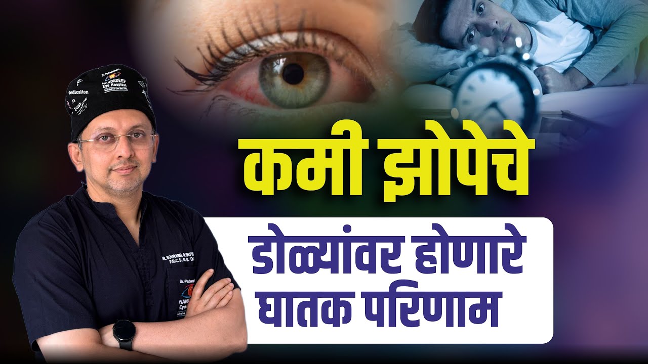 डोळ्यांच्या आरोग्यासाठी झोप महत्वाची | How Lack of Sleep Affects Your Eyes? | Dr. Sourabh Patwardhan