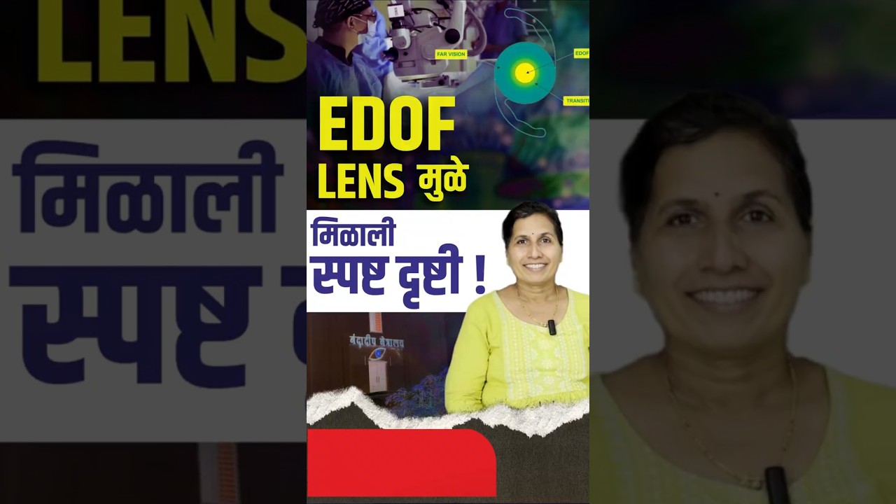 मोतीबिंदू सर्जरीनंतर EDOF लेन्समुळे मिळाली स्पष्ट दृष्टी Clear Vision with EDOF Lens चष्मा झाला दूर