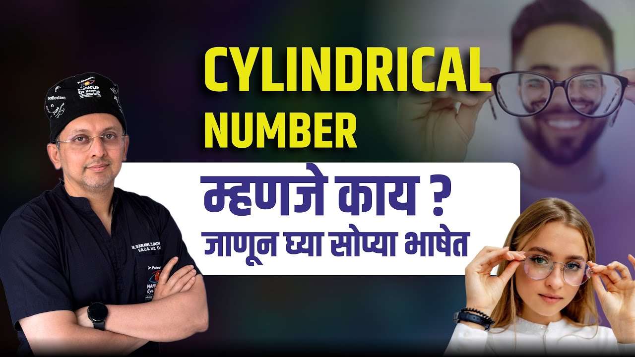 सिलिंड्रिकल नंबर म्हणजे काय? | जाणून घ्या सोप्या भाषेत | Cylindrical Eye Power Explained