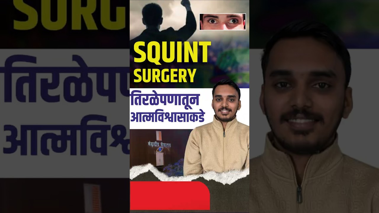स्क्विंट सर्जरी: तिरळे पणातून आत्मविश्वासाकडे