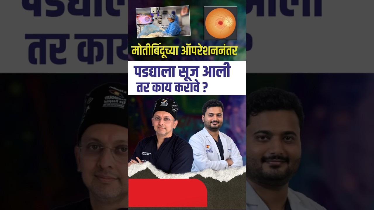 मोतीबिंदूच्या ऑपरेशननंतर पडद्याला सूज आली तर काय करावे?