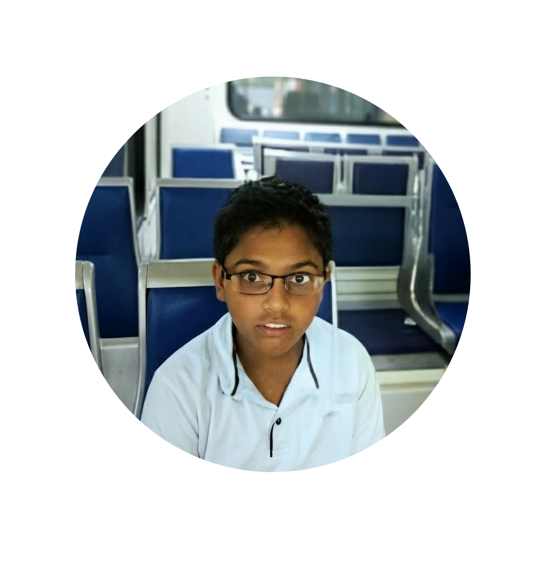 A Young Boy Sees Clearly Again A Success Story