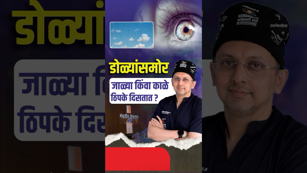 Truth about eye floaters