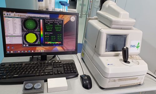 Our Ichalkaranji branch is now equipped with Corneal Topography (corneal mapping) machine with other latest tools to evaluate cornea. at Nandadeep Hospital