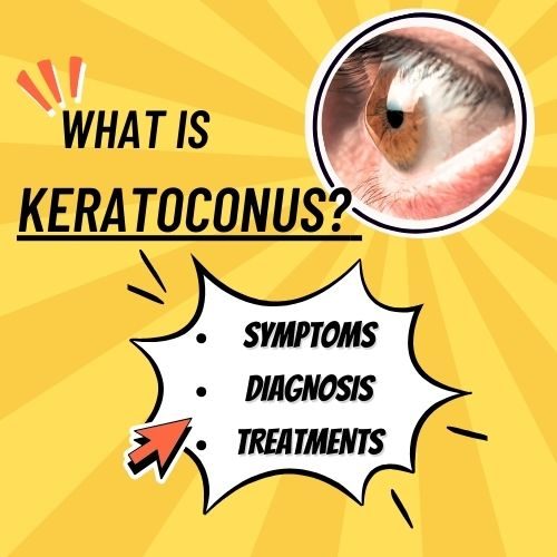 What is Keratoconus? Symptoms, Diagnosis, and Treatments