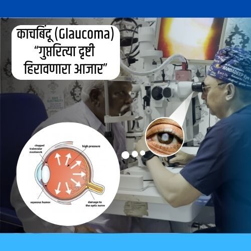 काचबिंदू (Glaucoma): नियमित नेत्रतपासणी का आवश्यक आहे?