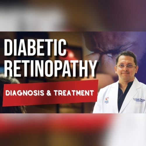 Eye Care for Diabetic Retinopathy: Diagnosis & Treatment