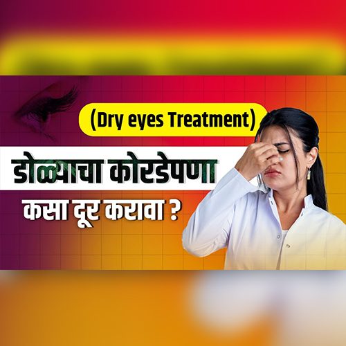 The Ultimate Guide to Preventing and Managing Dry Eyes Effectively