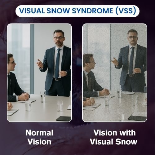 Visual Snow Syndrome: Causes, Symptoms, and Treatments